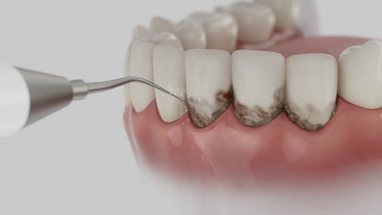 Reliable Emergency Dentist contractor in Olga, FL by Smile Center Dentistry